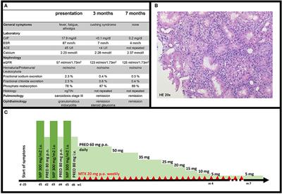 Case Report: Pediatric Renal Sarcoidosis and Prognostic Factors in Reviewed Cases